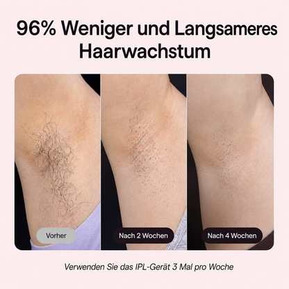 IPL Haarentfernungsgerät – Saphir-Eiskühlung für Körper & Gesicht